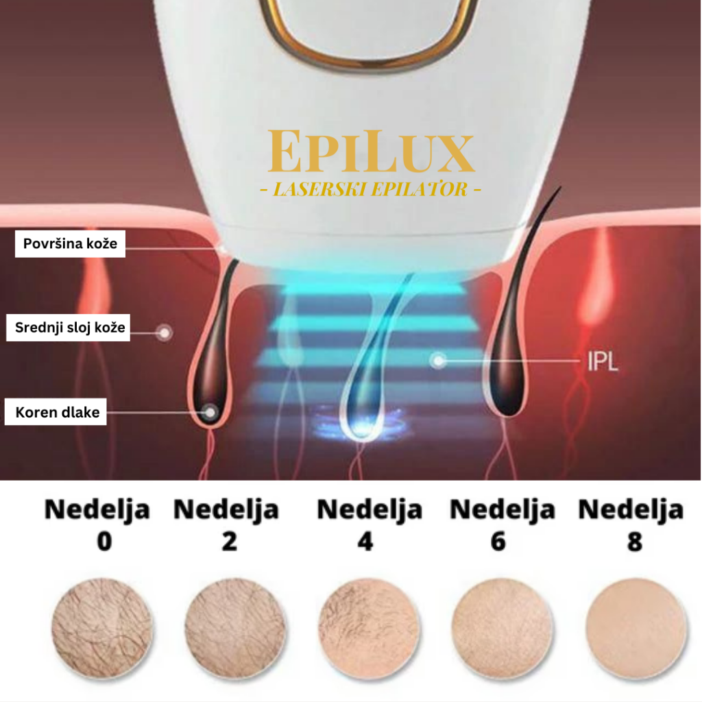 EpiLux Epilator