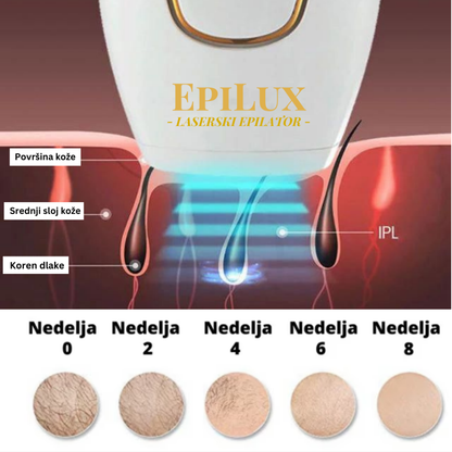 EpiLux Epilator