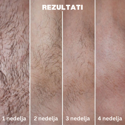 EpiLux Epilator