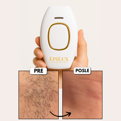 EpiLux Epilator